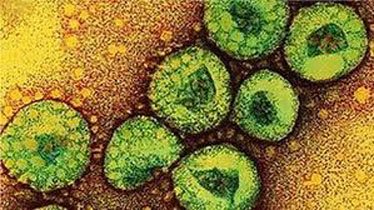 mers-virus-kills-27-called-a-threat-to-the-world-by-who
