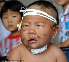 baby-stabbed-90-times-with-scissors-by-his-chinese-mother-after-he-bit-her-as-she-was-breastfeeding-him