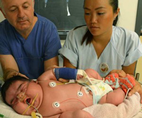 lady-in-germany-has-given-birth-to-one-of-the-heaviest-babies-ever-born