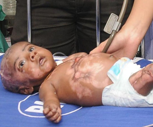 three-month-old-fire-baby-rahul