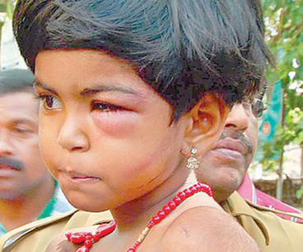 four-year-old-cruelly-beaten-by-father