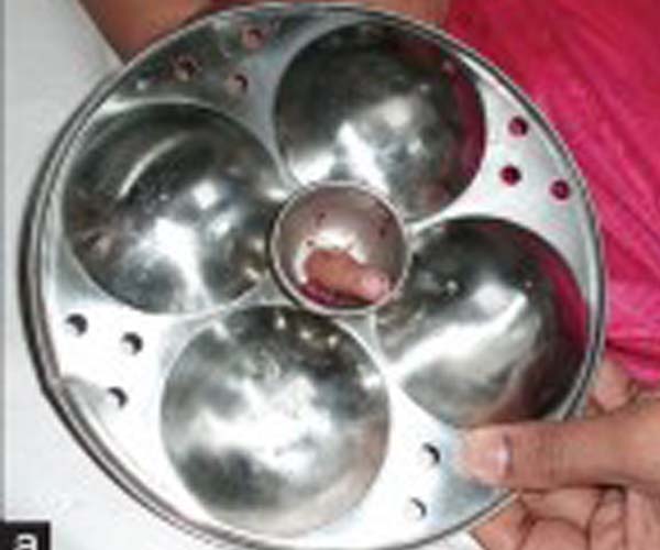finger-stuck-in-idli-mould-three-and-a-half-year-old-child-got-injured