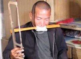 a-chinese-man-cut-his-leg-with-hacksaw-blade