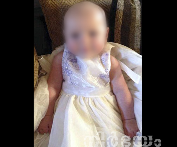 2year-old-child-died