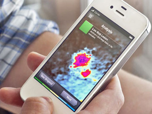 new-smartphone-app-detects-skin-cancer