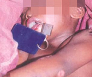 nigerian-father-arrested-for-fitting-padlock-to-sons-mouth-as-he-beat-him-to-death