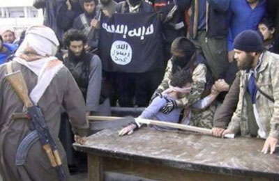 syrian-extremists-cut-off-mans-hand-as-punishment-for-stealing-and