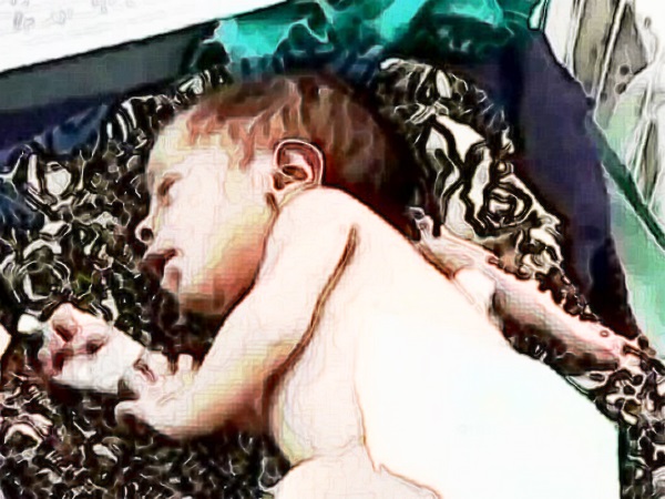 infant-born-with-three-legs-in-bopal