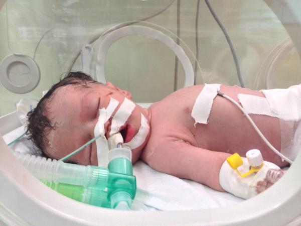 gazas-miracle-baby-dies-after-five-days