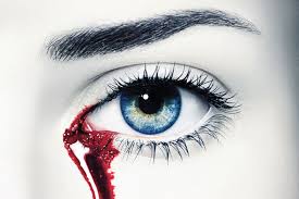 woman-suffering-from-rare-disease-sheds-blood-tears