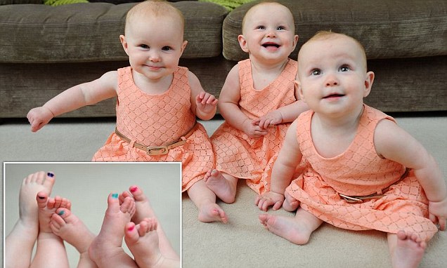 triplets-are-so-identical-parents-have-to-colour-code-their-toe-nails-to-identify-them