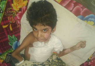 father-burned-8-year-old-daughter