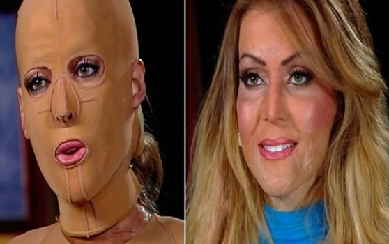 australian-woman-takes-mask-off-to-reveal-face