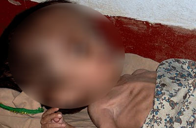 endosulfan-victim-45-days-old-dies