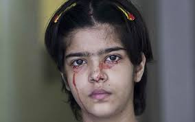 13-year-old-girl-cries-blood