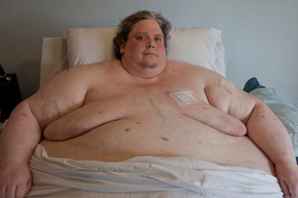 worlds-fattest-man-keith-martin-dead