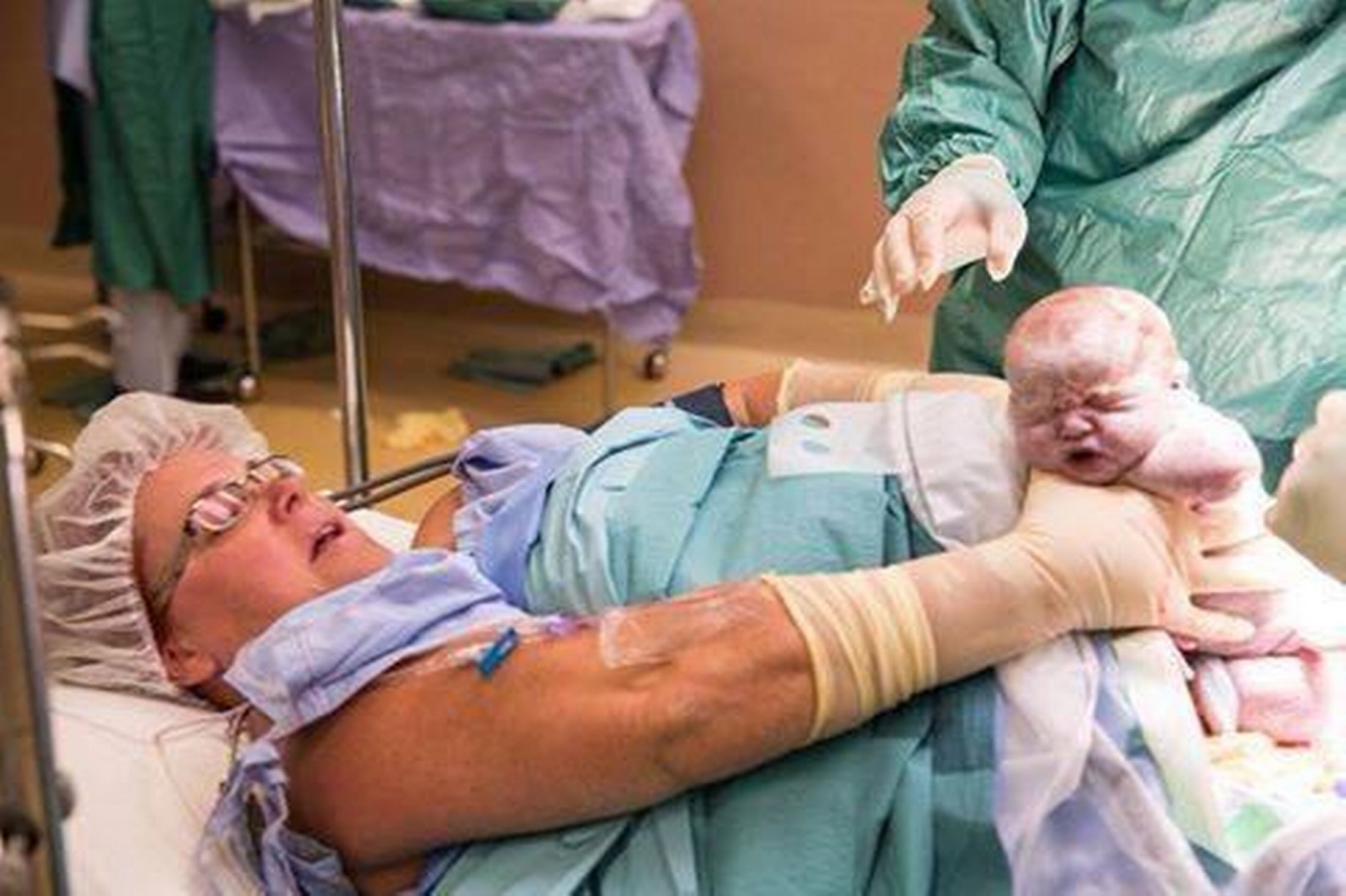 australian-woman-pulled-her-own-twins-from-her-tummy-during-caesarean-delivery
