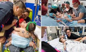 cojoined-texas-twins-survive-world-first-operation-to-separate-them