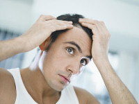 precautions-to-avoid-baldness