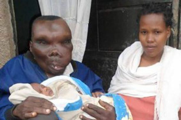 ugandas-ugliest-man-becomes-dad-for-the-eighth-time-with-his-second-wife
