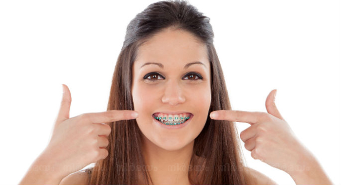 oral-hygiene-tips-for-people-with-braces