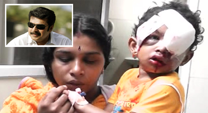 mammootty-offers-helping-stray-dog-attacked-3-year-old-boy