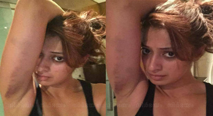 rai-lakshmi-injured-during-film-shooting