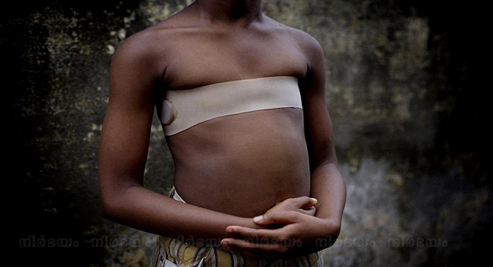 breast-ironing-ritual-sees-girls-having-their-chests-flattened-with-hot-stones