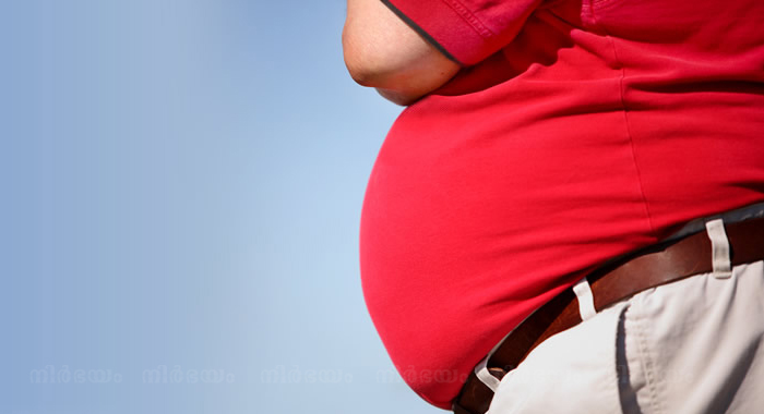 obesity-in-human