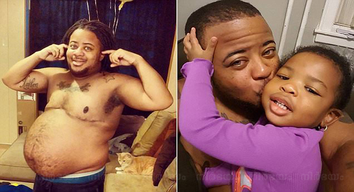 transgender-man-thought-he-was-out-of-shape-but-discovered-he-was-pregnant