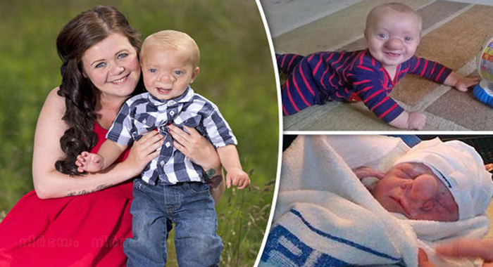 baby-ollie-is-a-real-life-pinocchio-says-proud-mum