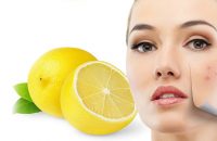 ways-use-lemon-juice-acne-scars