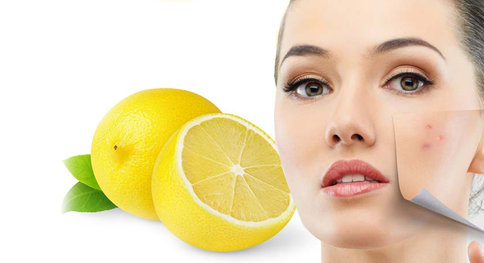 ways-use-lemon-juice-acne-scars