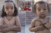 keshav-kumar-and-anjali-kumari-benjamin-button-children-look-like-pensioners