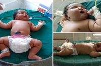 mum-gives-birth-to-heaviest-baby-in-india-weighing-15lb