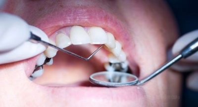 Teeth