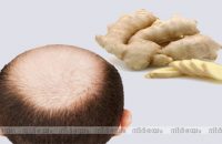 ginger-for-baldness
