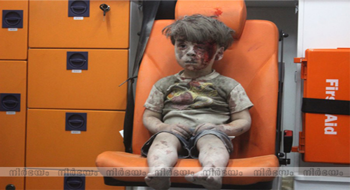 a-wounded-child-in-aleppo-silent-and-still-shocks-the-world