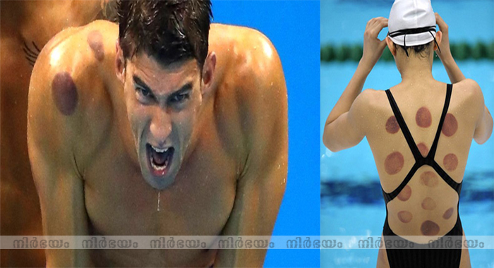 why-are-so-many-olympians-covered-in-large-red-circles