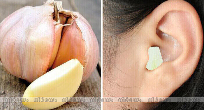 what-happens-when-you-put-garlic-in-your-ear-overnight