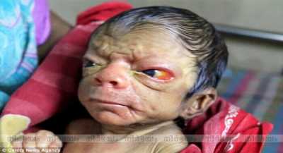 new-born-baby