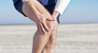 arthritis