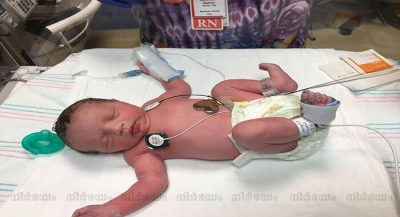 baby-born-for-second-time-after-shes-taken-from-mums-womb