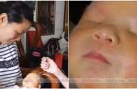 baby-born-with-no-eyes-in-guangzhou