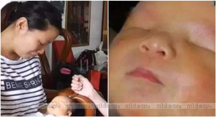baby-born-with-no-eyes-in-guangzhou