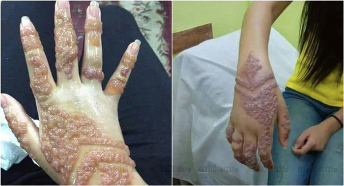 decoding-the-truth-behind-the-chinese-mehendi-photos-that-went-viral