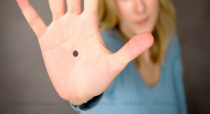meaning-of-moles-on-the-hand-moles-on-the-hand