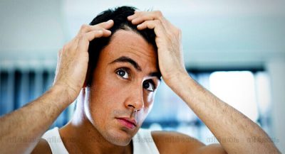 reasons-for-bald-man