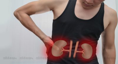 kidney-disease