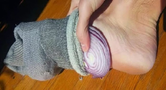 put-onions-in-your-socks-before-going-to-bed